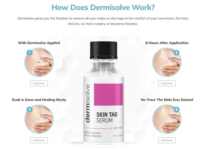 Cryogen Skin Tag Remover