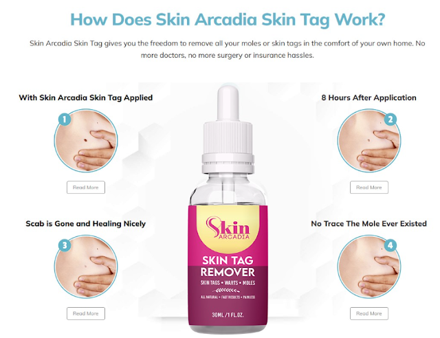 Skin Arcadia Skin Tag Remover